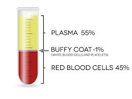 Plasma diagram