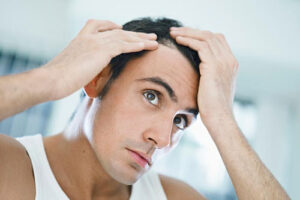 Hair restoration in South Florida