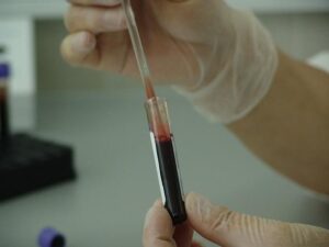 Functional medicine in Miami as bloodwork is sent for testing